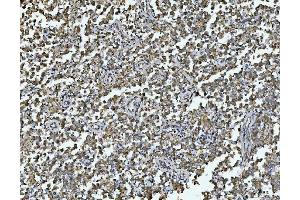 IHC analysis of ARL13B using anti-ARL13B antibody (ABIN7600179). (ARL13B Antikörper  (AA 16-428))