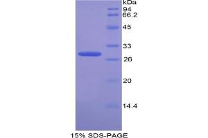 SDS-PAGE analysis of Cow Transportin 1 Protein. (Transportin 1 Protein (TNPO1))