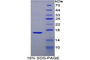 SDS-PAGE (SDS) image for T-Cell Leukemia/lymphoma 1A (TCL1A) (AA 6-112) protein (His tag) (ABIN1878911) (TCL1A Protein (AA 6-112) (His tag))