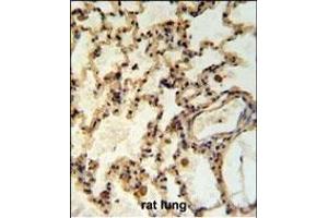 IL Antibody (Center) (ABIN653951 and ABIN2843173) IHC analysis in formalin fixed and paraffin embedded rat lung tisssue followed by peroxidase conjugation of the secondary antibody and DAB staining. (IMMP2L Antikörper  (AA 81-109))