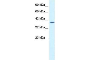 Human HepG2; WB Suggested Anti-PSMD14 Antibody Titration: 1. (PSMD14 Antikörper  (N-Term))