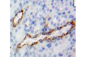 Used in DAB staining on fromalin fixed paraffin-embedded Kidney tissue (CD73 Antikörper  (AA 29-550))