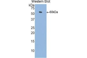 Western blot analysis of the recombinant protein. (L1CAM Antikörper  (AA 882-1132))