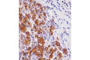 (ABIN6243770 and ABIN6577238) staining REG3G in human pancreas tissue sections by Immunohistochemistry (IHC-P - paraformaldehyde-fixed, paraffin-embedded sections).
