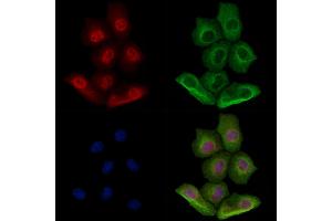 Phospho-XBP1 (Ser68) Antibody staining Hela cells(heat shock treatment) by IF/ICC. (XBP1 Antikörper  (pSer68))