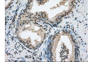 Immunohistochemical staining of paraffin-embedded colon tissue using anti-ACSBG1 mouse monoclonal antibody.