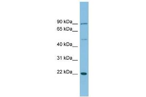 DNAJC12 antibody used at 1 ug/ml to detect target protein. (DNAJC12 Antikörper)