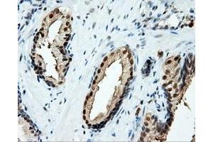 Immunohistochemical staining of paraffin-embedded liver tissue using anti-TPMT mouse monoclonal antibody. (TPMT Antikörper)