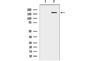 anti-Zinc Finger, FYVE Domain Containing 16 (ZFYVE16) (C-Term) antibody