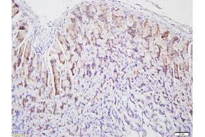 Formalin-fixed and paraffin embedded rat stomach labeled with Anti-pan Cytokeratin Polyclonal Antibody, Unconjugated  at 1:500 followed by conjugation to the secondary antibody and DAB staining. (pan Keratin Antikörper  (AA 331-430))