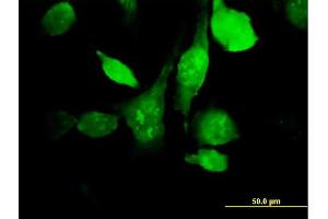 Immunofluorescence of purified MaxPab antibody to HYAL3 on HeLa cell. (HYAL3 Antikörper  (AA 1-417))