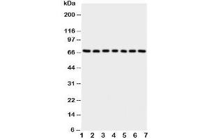 Western blot testing of NOX4 antibody and Lane 1:  rat kidney;  2: (r) heart;  3: (r) spleen;  4: human HeLa;  5: (h) 293T;  6: (h) MCF-7;  7: (h) SMMC-7721 cell lysate. (NADPH Oxidase 4 Antikörper  (C-Term))