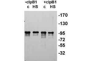 Western Blotting (WB) image for anti-ClpB2 Gene Product (CLPB2) antibody (ABIN334578)
