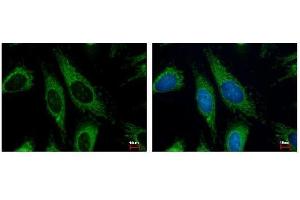 ICC/IF Image HADHA antibody detects HADHA protein at Mitochondria by immunofluorescent analysis. (HADHA Antikörper  (C-Term))