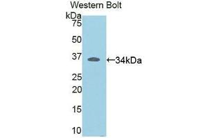 Western blot analysis of the recombinant protein. (RELB Antikörper  (AA 176-436))