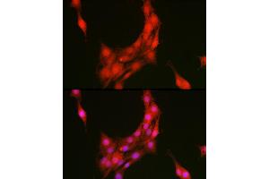 Immunofluorescence (IF) image for anti-Annexin A1 (ANXA1) antibody (ABIN6133581)