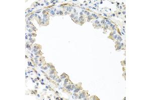Immunohistochemistry of paraffin-embedded mouse lung using IL22 antibody (ABIN5975407) at dilution of 1/100 (40x lens). (IL-22 Antikörper)