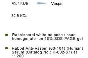 Detection of Vaspin in rat visceral fat tissue by Western Blot Kit (SERPINA12 Antikörper  (AA 63-104))