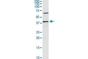 SERPINB2 MaxPab rabbit polyclonal antibody. (SERPINB2 Antikörper  (AA 1-415))