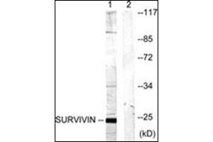 Western blot analysis of extracts from mouse lung cells, using Survivin Antibody . (Survivin Antikörper)