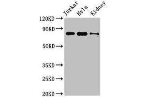 Western Blot Positive WB detected in: Jurkat whole cell lysate, Hela whole cell lysate, Mouse kidney tissue All lanes: NOA1 antibody at 3. (C4orf14 Antikörper  (AA 42-174))
