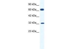 Western Blotting (WB) image for anti-Potassium Intermediate/small Conductance Calcium-Activated Channel, Subfamily N, Member 1 (KCNN1) antibody (ABIN2461099) (KCNN1 Antikörper)