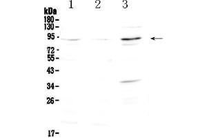 Western blot analysis of FOXP2 using anti-FOXP2 antibody . (FOXP2 Antikörper  (AA 637-715))