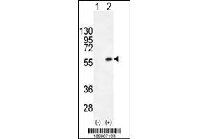 Western blot analysis of PKMYT1 using rabbit polyclonal PKMYT1 C-term using 293 cell lysates (2 ug/lane) either nontransfected (Lane 1) or transiently transfected (Lane 2) with the PKMYT1 gene.