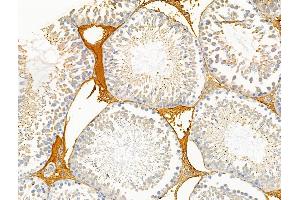 ABIN6257536 and ABIN6274704 at 1/100 staining Rat testis tissue by IHC-P. (TRAF3IP3 Antikörper  (Internal Region))
