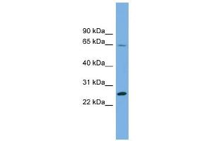 DHFRL1 antibody used at 1 ug/ml to detect target protein. (DHFRL1 Antikörper  (Middle Region))