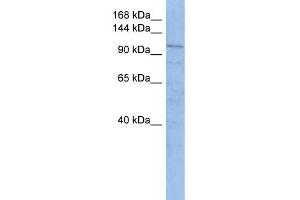 WB Suggested Anti-TRAK1 Antibody Titration: 0. (TRAK1 Antikörper  (Middle Region))