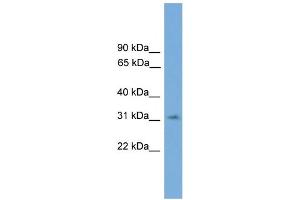 WB Suggested Anti-SPRY3 Antibody Titration:  0. (SPRY3 Antikörper  (N-Term))
