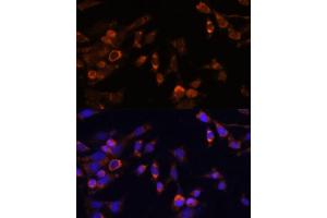 Immunofluorescence analysis of NIH-3T3 cells using PSMB7 Polyclonal Antibody (ABIN7269594) at dilution of 1:100 (40x lens). (PSMB7 Antikörper  (AA 44-200))