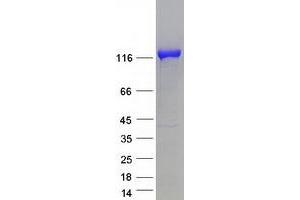 SMARCA1 Protein (Transcript Variant 1) (Myc-DYKDDDDK Tag)