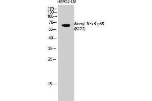 Western Blotting (WB) image for anti-Nuclear Factor-kB p65 (NFkBP65) (acLys122) antibody (ABIN3178882) (NF-kB p65 Antikörper  (acLys122))