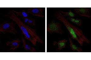Immunofluorescence analysis of Hela cells using SOX9 mouse mAb (green). (SOX9 Antikörper)