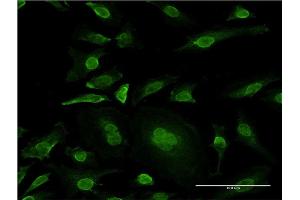 Immunofluorescence of monoclonal antibody to MAPK10 on HeLa cell. (MAPK10 Antikörper  (AA 1-319))