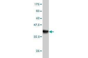 Western Blot detection against Immunogen (36. (FOXA2 Antikörper  (AA 363-457))