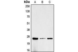 Western blot analysis of CG beta expression in MCF7 (A), SP2/0 (B), rat kidney (C) whole cell lysates.