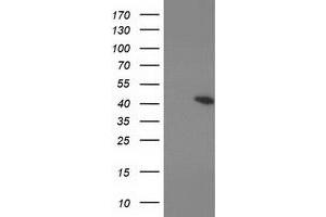 Western Blotting (WB) image for anti-Protein Kinase, CAMP-Dependent, Regulatory, Type I, beta (PRKAR1B) antibody (ABIN1500409) (PRKAR1B Antikörper)