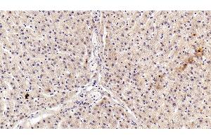 Detection of AngI in Porcine Liver Tissue using Polyclonal Antibody to Angiotensin I (AngI) (AGT Antikörper)