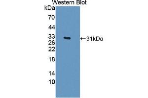 Western Blotting (WB) image for anti-Cadherin EGF LAG Seven Pass G-Type Receptor 3 (CELSR3) (AA 1181-1421) antibody (ABIN7443452)