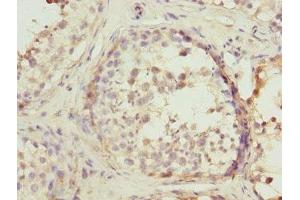 Immunohistochemistry of paraffin-embedded human testis tissue using ABIN7167503 at dilution of 1:100 (PTPRE Antikörper)