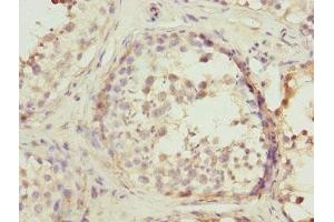 Immunohistochemistry (IHC) image for anti-Protein tyrosine Phosphatase, Receptor Type, E (PTPRE) antibody (ABIN7167503)