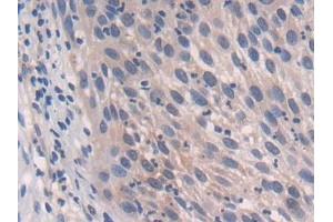 Immunohistochemistry (IHC) image for anti-P450 (Cytochrome) Oxidoreductase (POR) (AA 77-518) antibody (ABIN7435475)