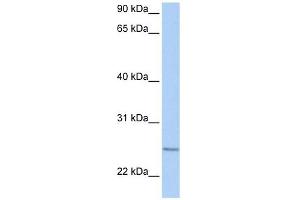 RABL4 antibody used at 1 ug/ml to detect target protein. (RABL4 Antikörper  (C-Term))