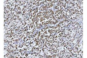 IHC analysis of GLUD1/2 using anti-GLUD1/2 antibody (ABIN7602000). (GLUD1 / GLUD2 (AA 54-553) Antikörper)