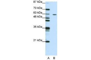 Western Blot showing ZNF382 antibody used at a concentration of 1-2 ug/ml to detect its target protein. (ZNF382 Antikörper  (N-Term))