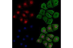 Phospho-YY1 (Ser365) Antibody staining Hela cells(heat shock treatment) by IF/ICC. (YY1 Antikörper  (pSer365))