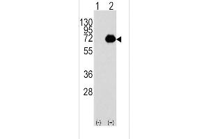 Western blot analysis of ACOX1 (arrow) using rabbit polyclonal ACOX1 Antibody (C-term) (R).